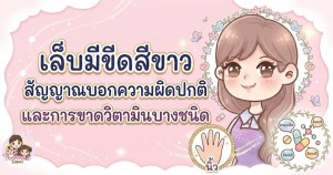 เล็บมีขีดสีขาว สัญญาณบอกความผิดปกติ และการขาดวิตามินบางชนิด