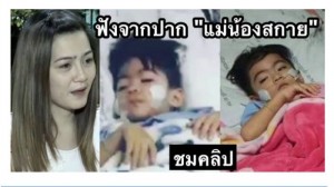 สัมภาษณ์ล่าสุด แม่น้องสกายกังวล น้องสกายย้ายเข้าICU ด่วน !!!