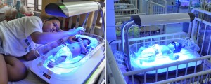 ภาวะตัวเหลืองในเด็กแรกเกิด (Neonatal jaundice)