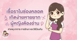 เชื้อราในช่องคลอด เกิดง่ายหายยาก ผู้หญิงต้องอ่าน