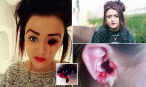 สาว 17 ป่วยประหลาด เลือดไหลออกจากตา หู จมูก วันละ 5 ครั้ง