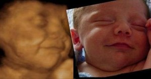 คลิป พัฒนาการทารกในครรภ์ ผ่านอัลตราซาวด์ 4 มิติอายุครรภ์ 6 – 40 สัปดาห์