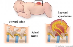 5 เหตุผลว่าทำไม่ควรเเชร์เรื่องของลูกบนโลกออนไลน์