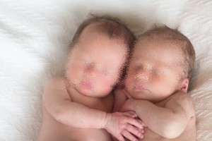 ทารกแฝดวัย 3เดือน เสียชีวิตจากอากาศแปรปรวน