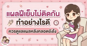 แผลฝีเย็บไม่ติดกัน ทำอย่างไรดี ควรดูแลแผลหลังคลอดยังไง