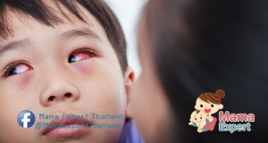 ลูกน้อยขยี้ตา ระวังโรคเยื่อบุตาอักเสบในเด็ก โรคใกล้ตัวที่คุณแม่ควรรู้